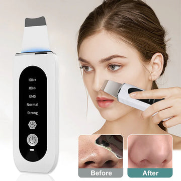 hovel Skin Blackhead Ultrasonic Beauty Microcurrent Color Light
