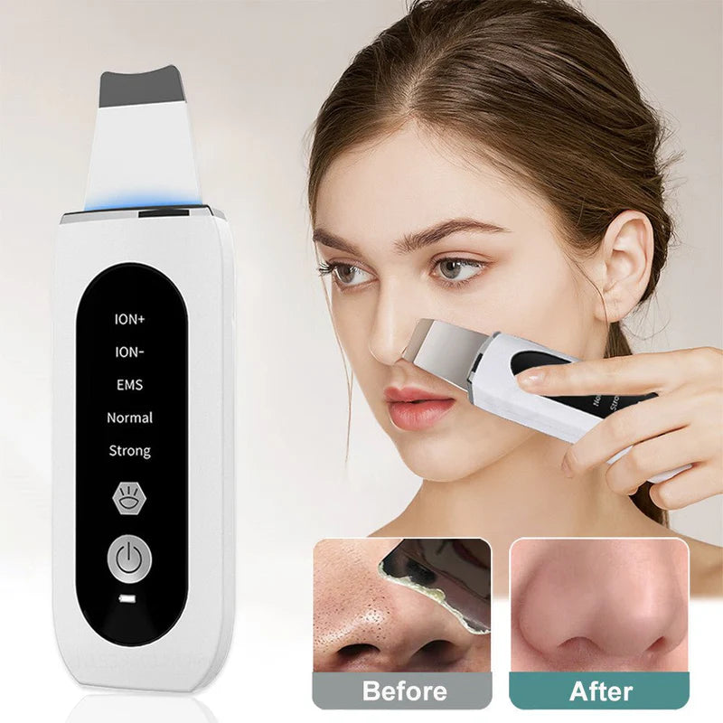 hovel Skin Blackhead Ultrasonic Beauty Microcurrent Color Light