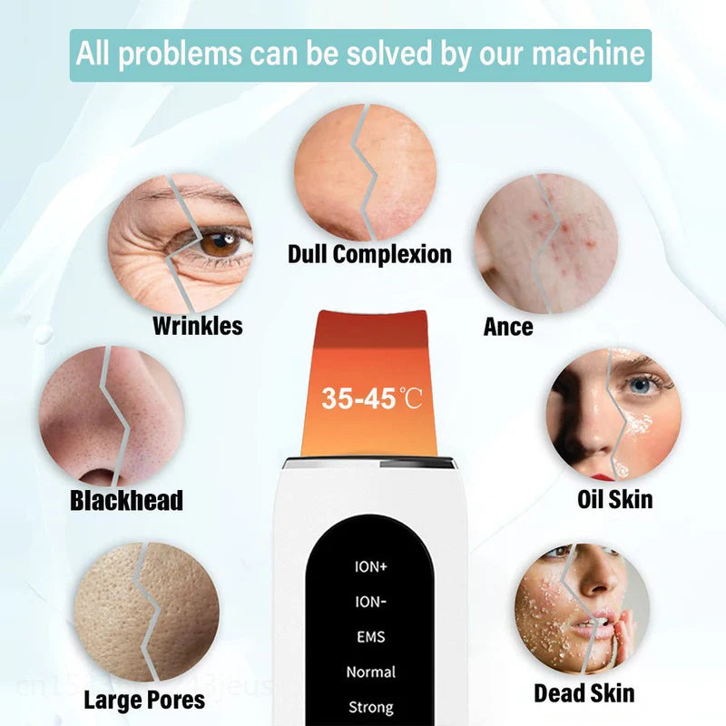 hovel Skin Blackhead Ultrasonic Beauty Microcurrent Color Light